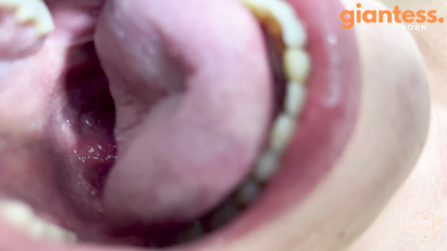  Vore
