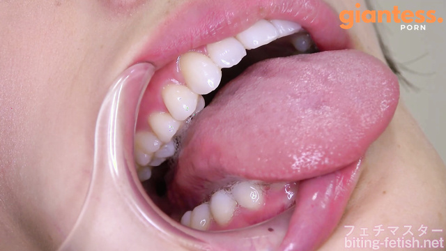  Vore