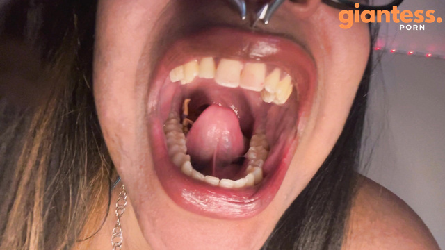  Vore