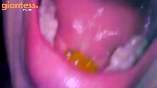  Vore